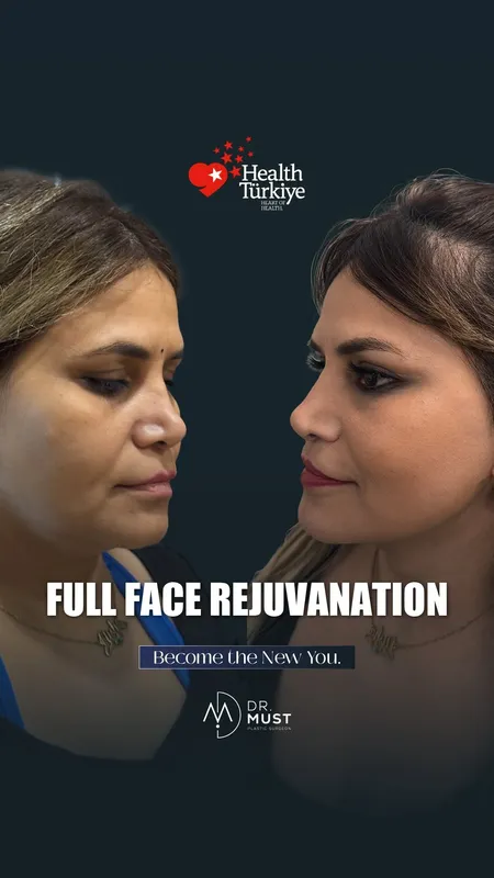 Before and after — Dr. Mustafa Onal