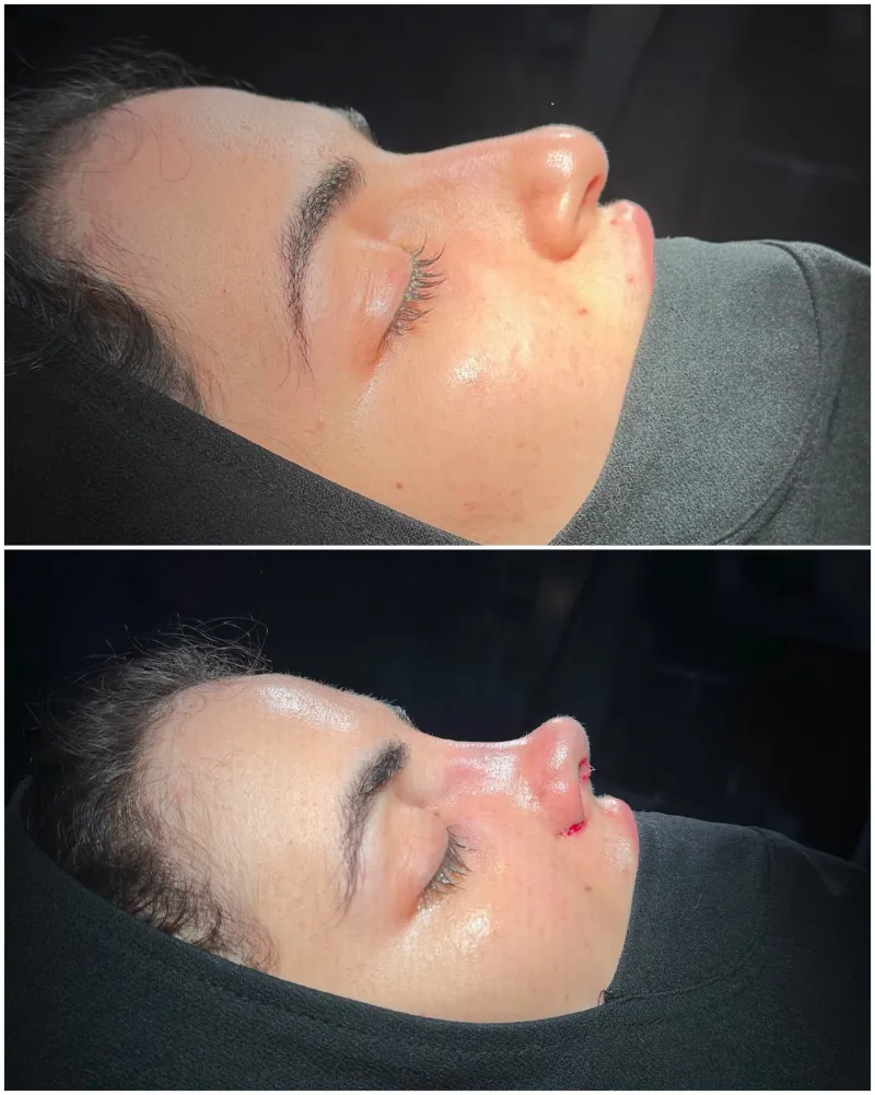 Before and after — Dr. Mustafa Karakaş