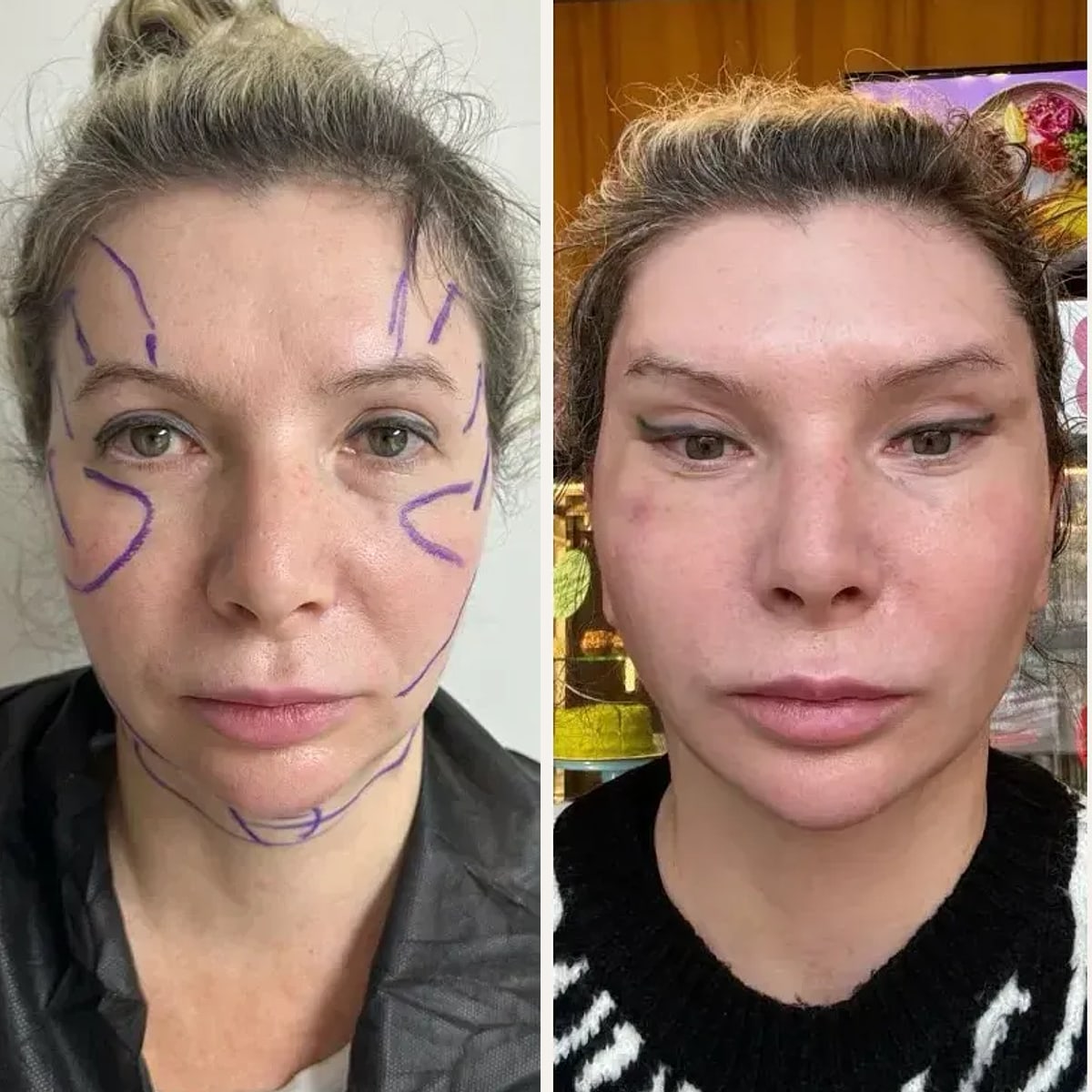 Before and after: Dr. Mustafa Unal