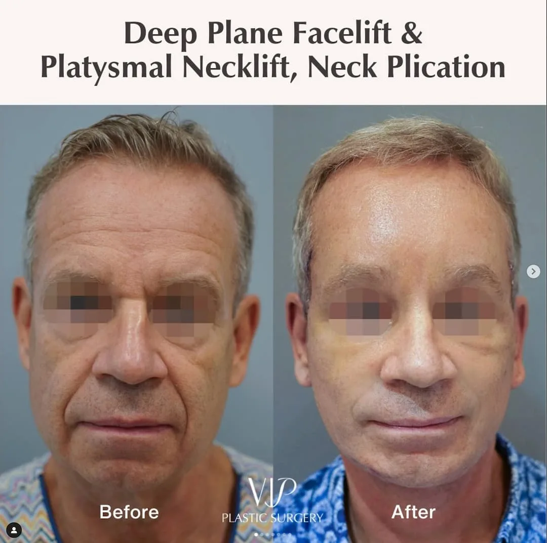 Before and after — Dr. Myung Ju Lee