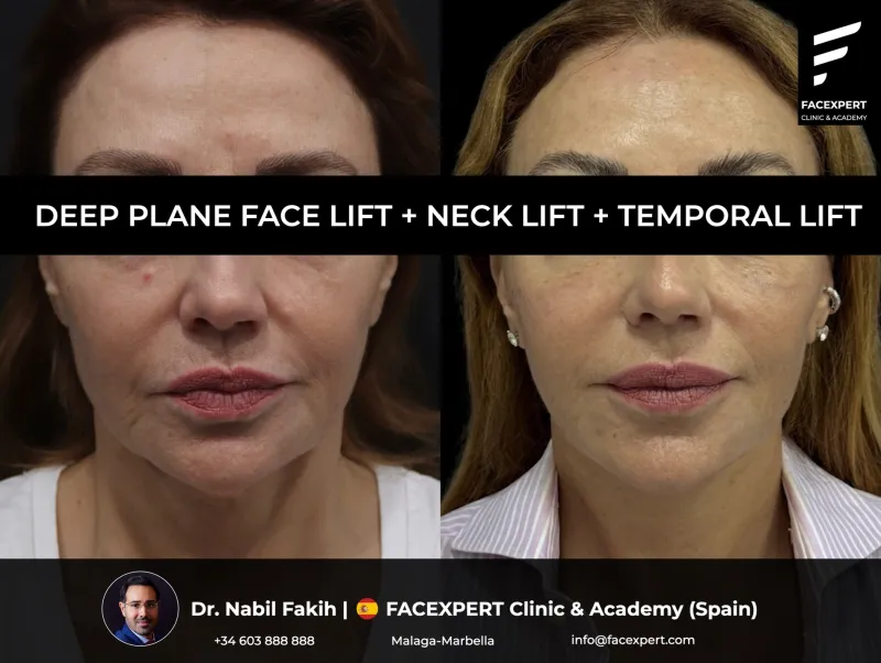 Before and after: Dr. Nabil Fakih
