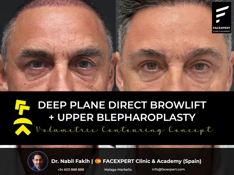 Before and after: Dr. Nabil Fakih
