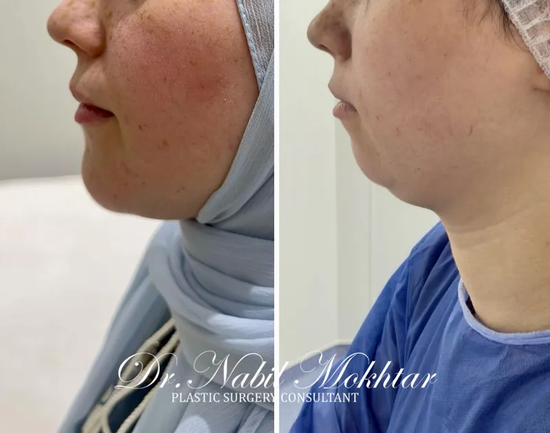 Before and after — Dr. Nabil Mokhtar