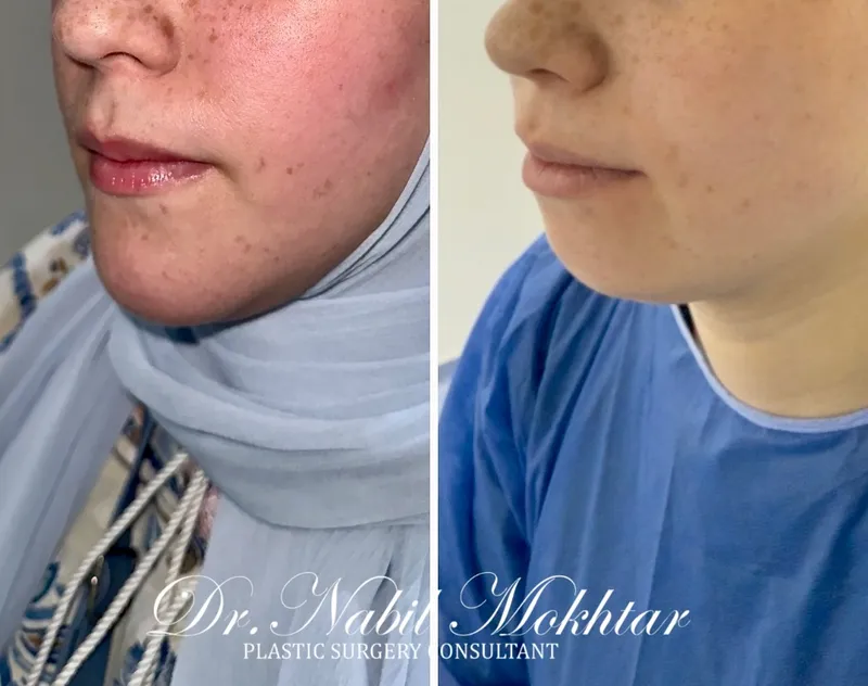 Before and after — Dr. Nabil Mokhtar