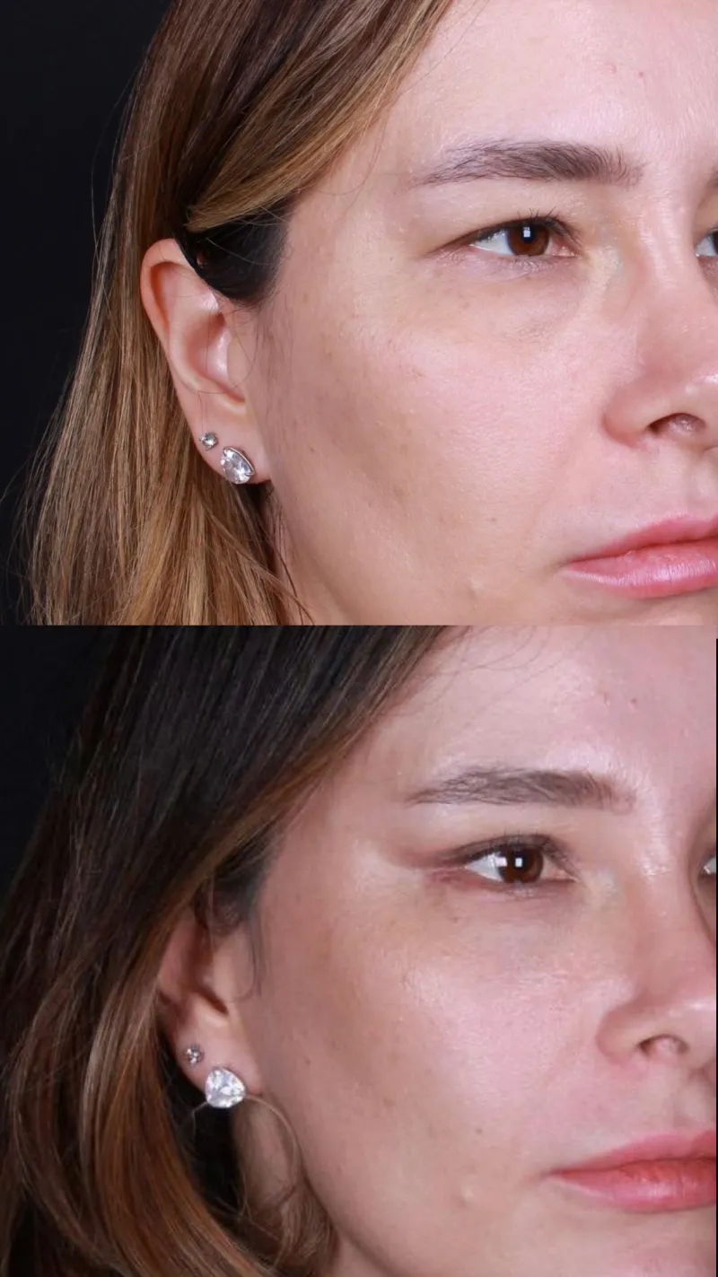 Before and after: Dr. Naiara Floris