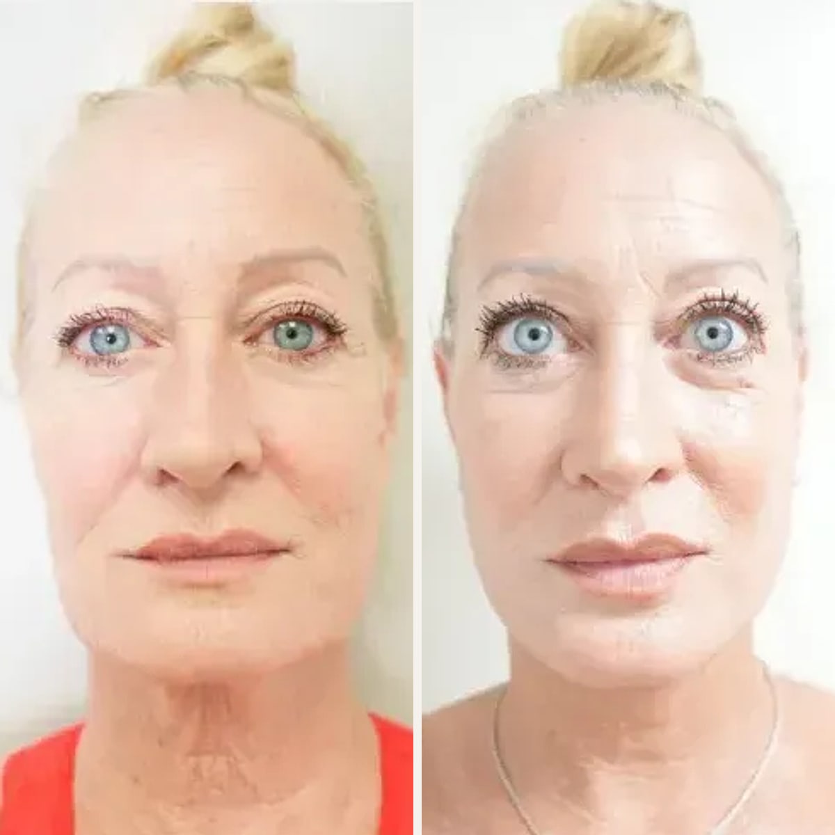 Before and after: Dr. Narayanan Nair