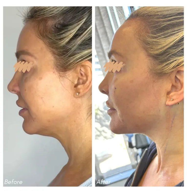 Before and after — Dr. Neal Deot