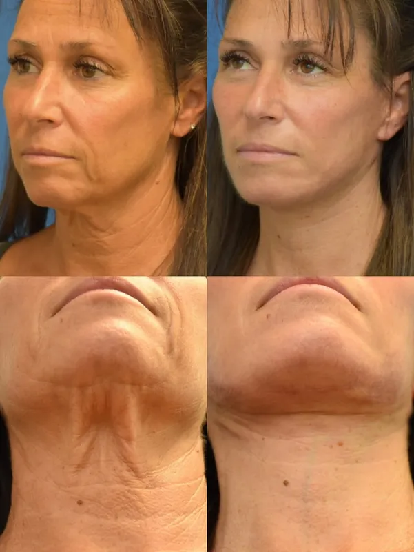 Before and after — Dr. Neal Goldberg