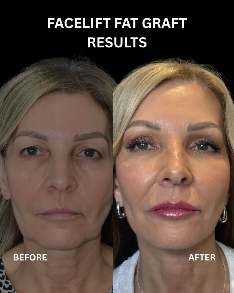 Before and after: Dr. Neophytos Demetriades