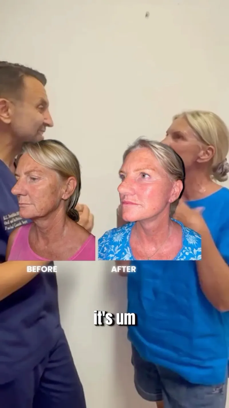 Before and after: Dr. Neophytos Demetriades