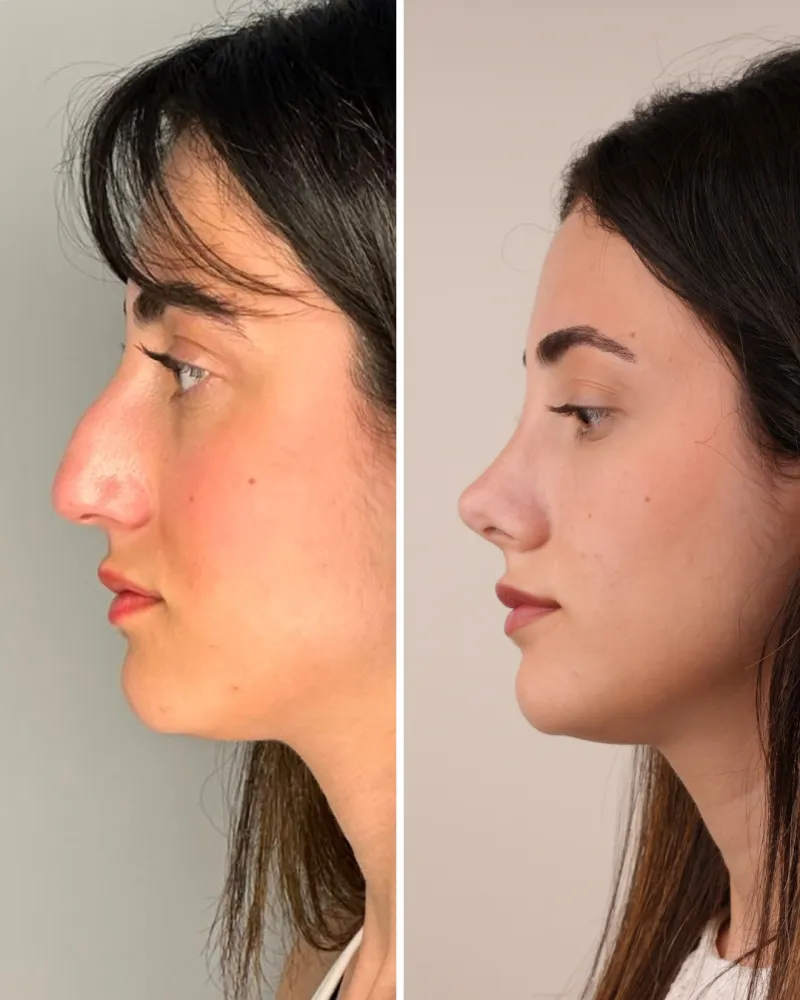Before and after — Dr. Nicat Mecidov