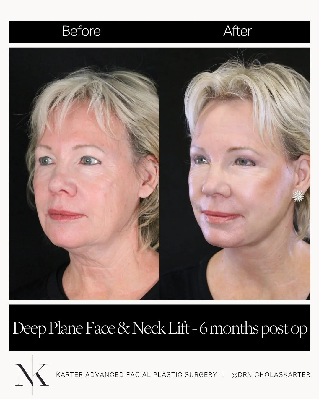 Before and after — Dr. Nicholas Karter