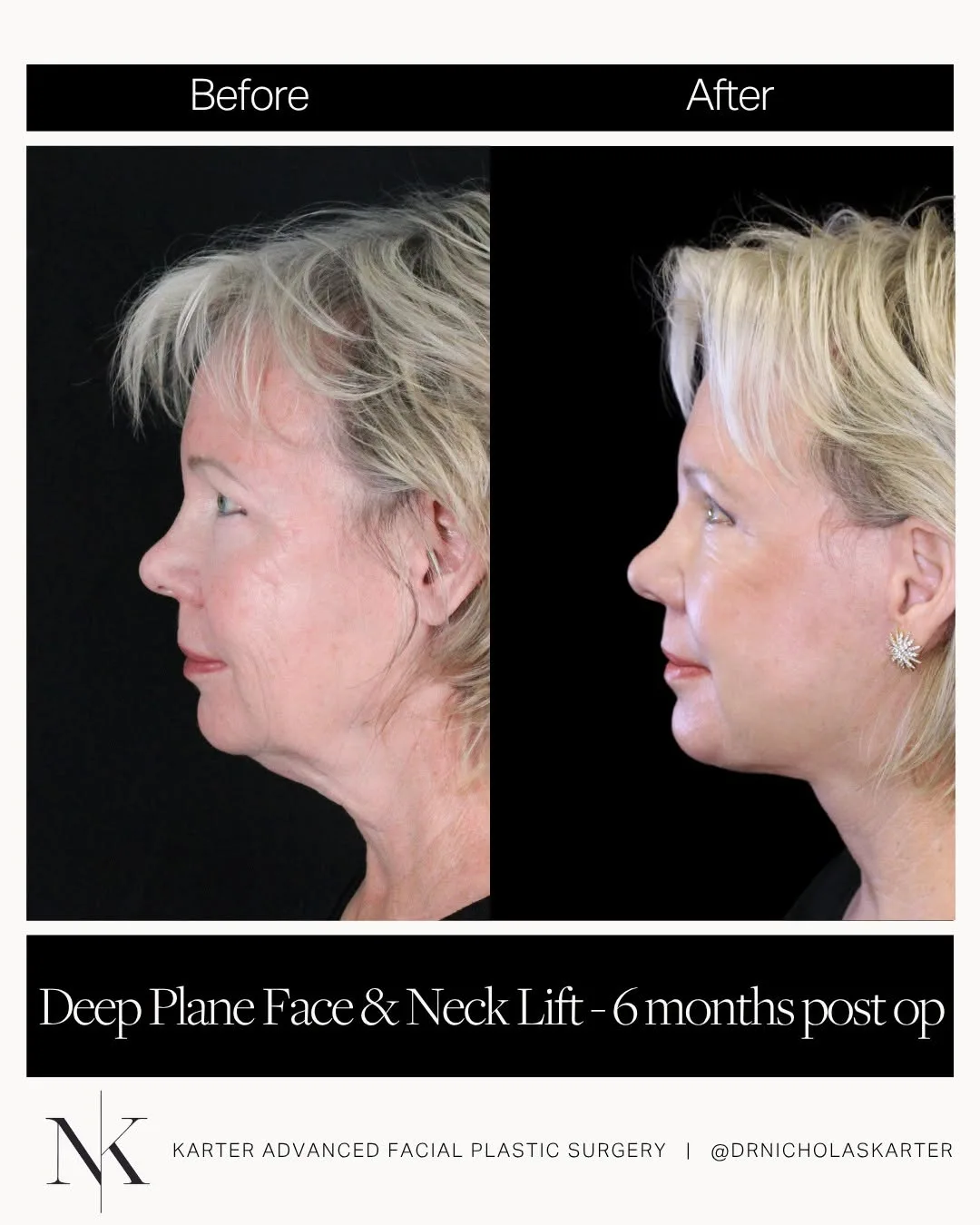 Before and after — Dr. Nicholas Karter
