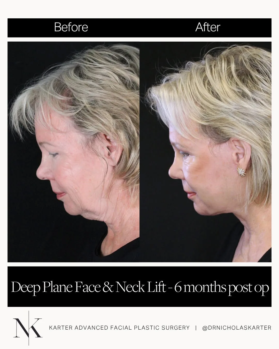 Before and after — Dr. Nicholas Karter