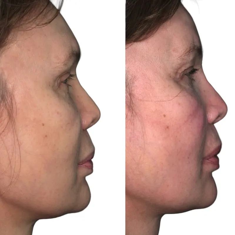 Before and after — Dr. Nicola Beneduce