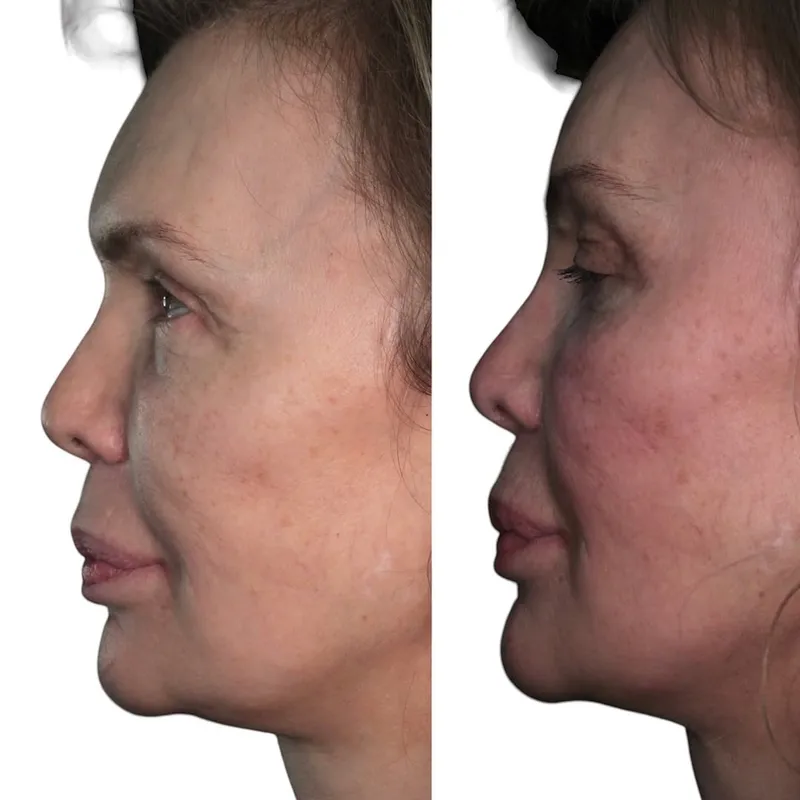 Before and after — Dr. Nicola Beneduce