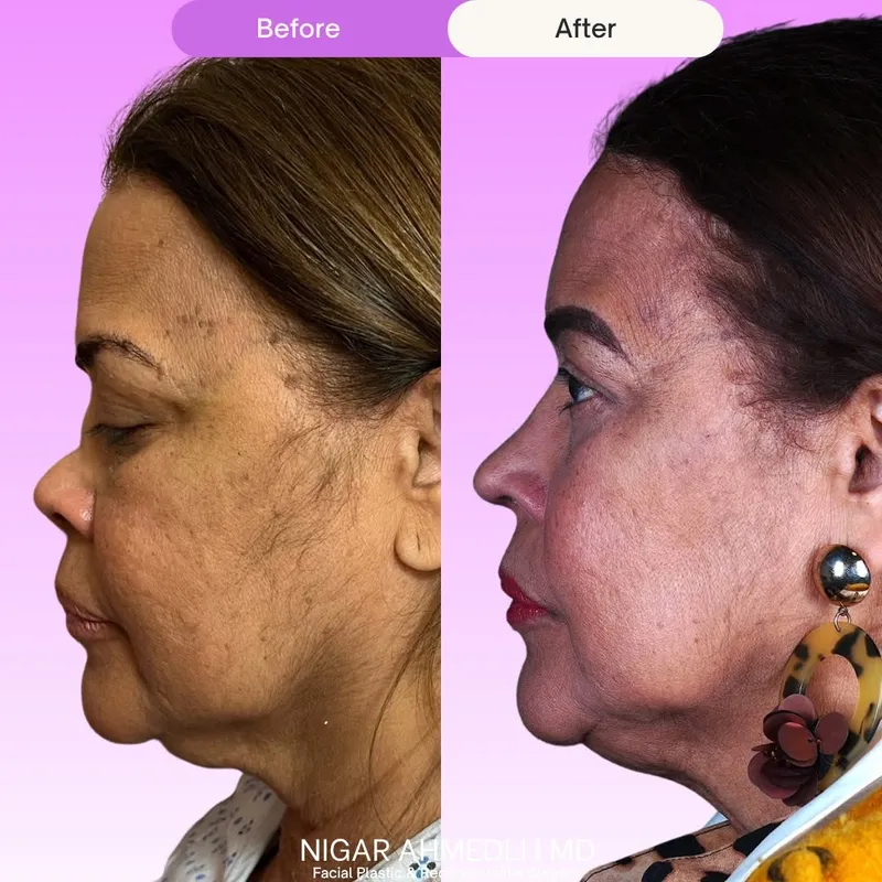 Before and after — Dr. Nigar N. Ahmedli