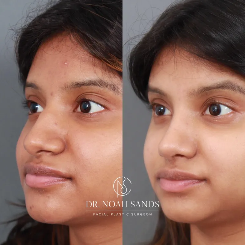 Before and after — Dr. Noah Sands