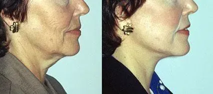 Before and after — Dr. Norman Pastorek