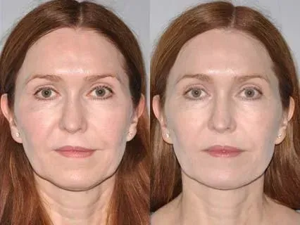 Before and after — Dr. Norman Pastorek