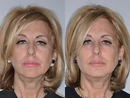 Before and after — Dr. Norman Pastorek