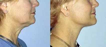Before and after — Dr. Norman Pastorek
