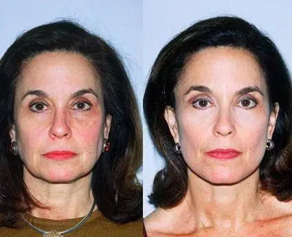 Before and after — Dr. Norman Pastorek
