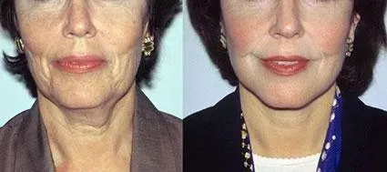 Before and after — Dr. Norman Pastorek