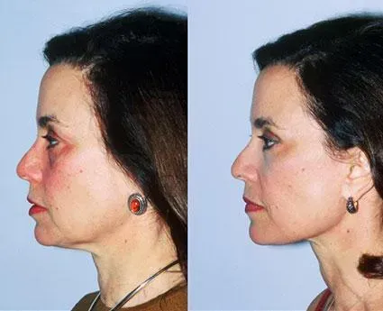 Before and after — Dr. Norman Pastorek