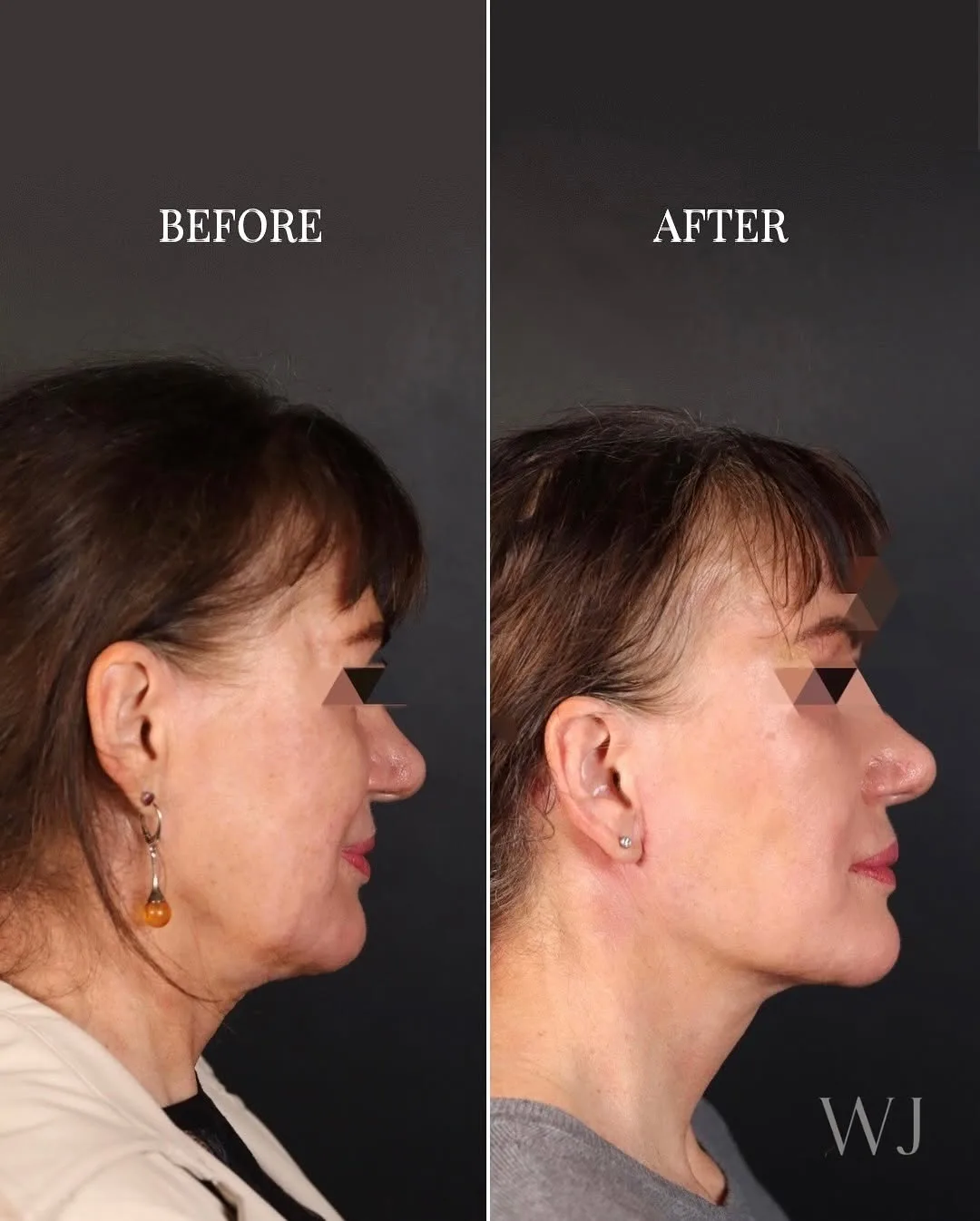 Before and after — Dr. Norman Waterhouse