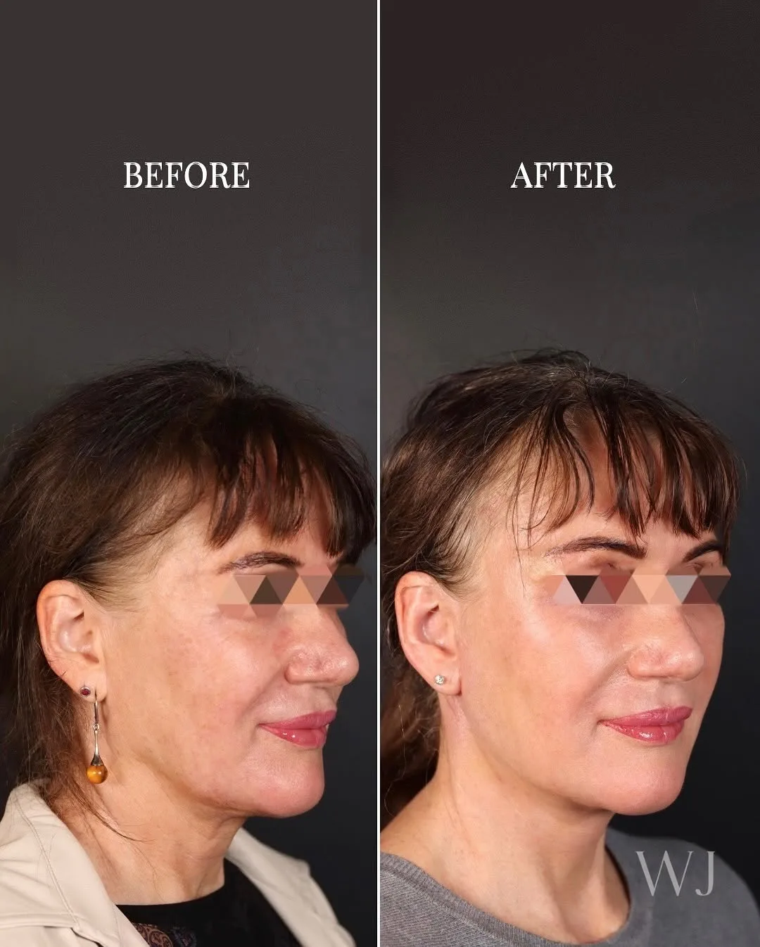Before and after — Dr. Norman Waterhouse