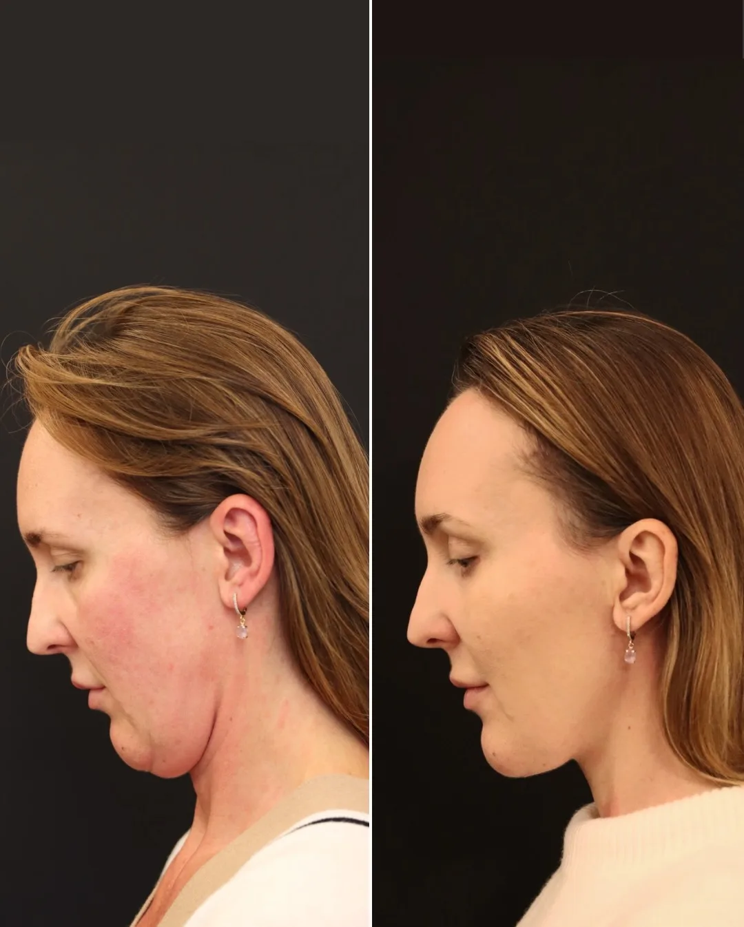 Before and after — Dr. Norman Waterhouse