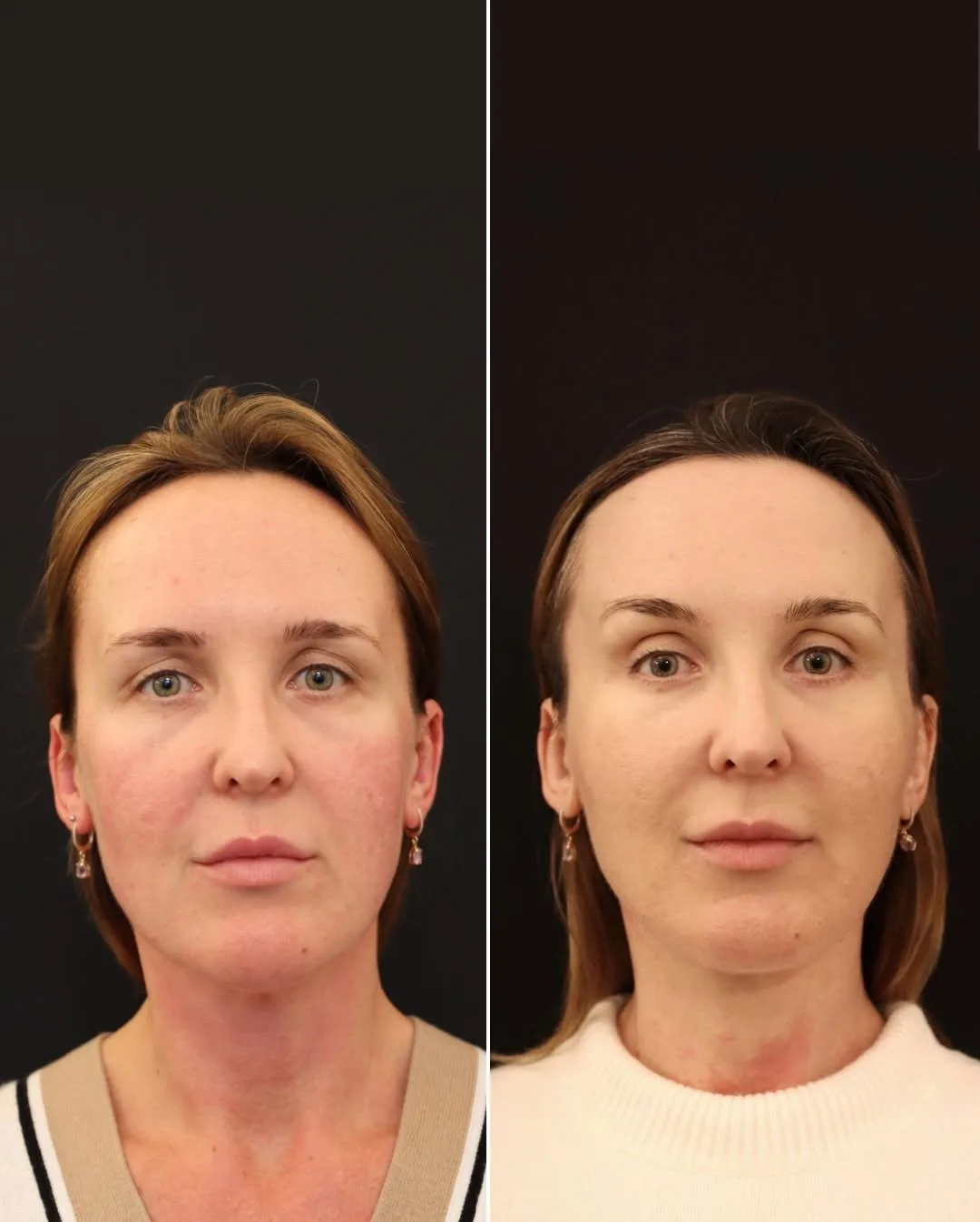 Before and after — Dr. Norman Waterhouse