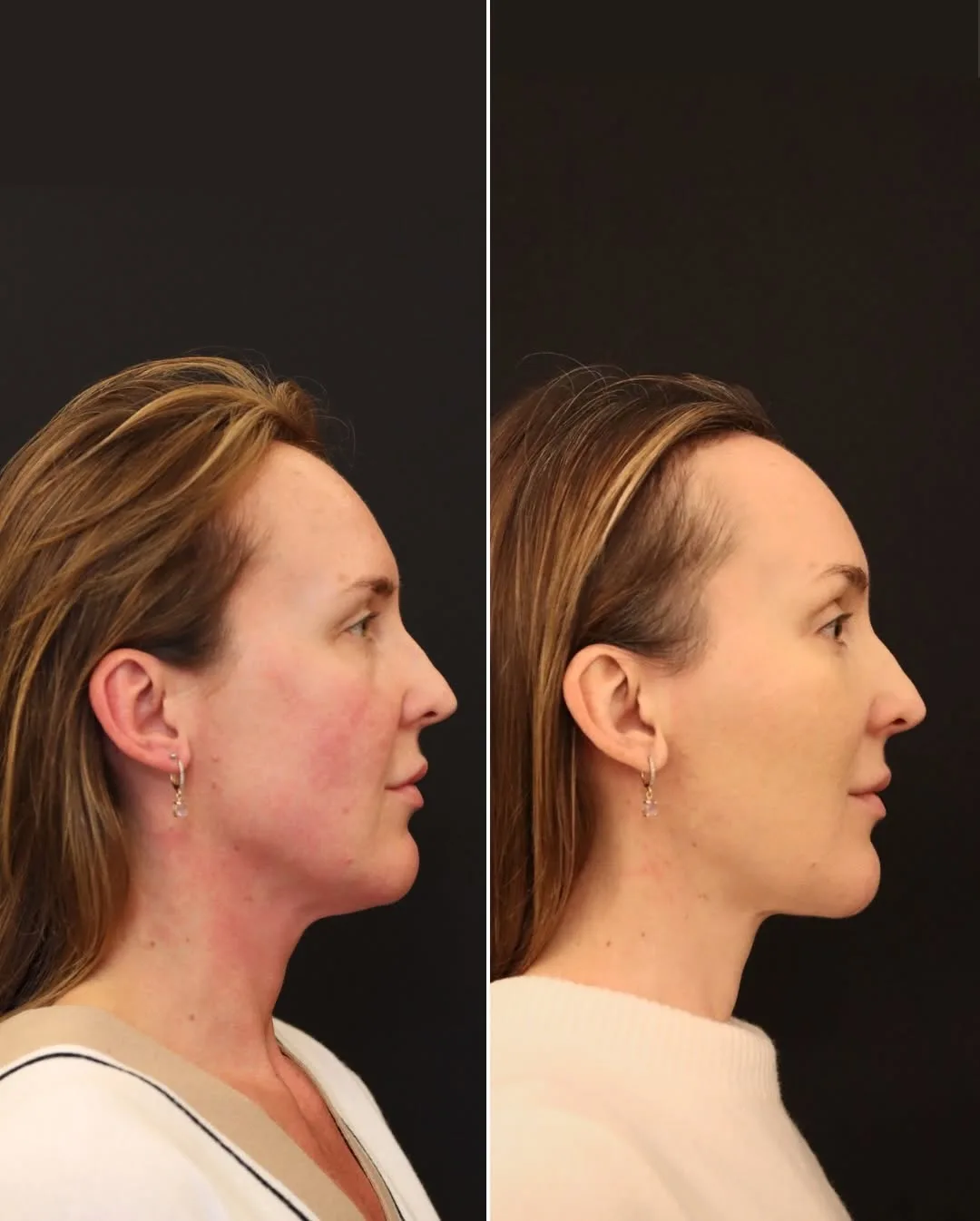 Before and after — Dr. Norman Waterhouse