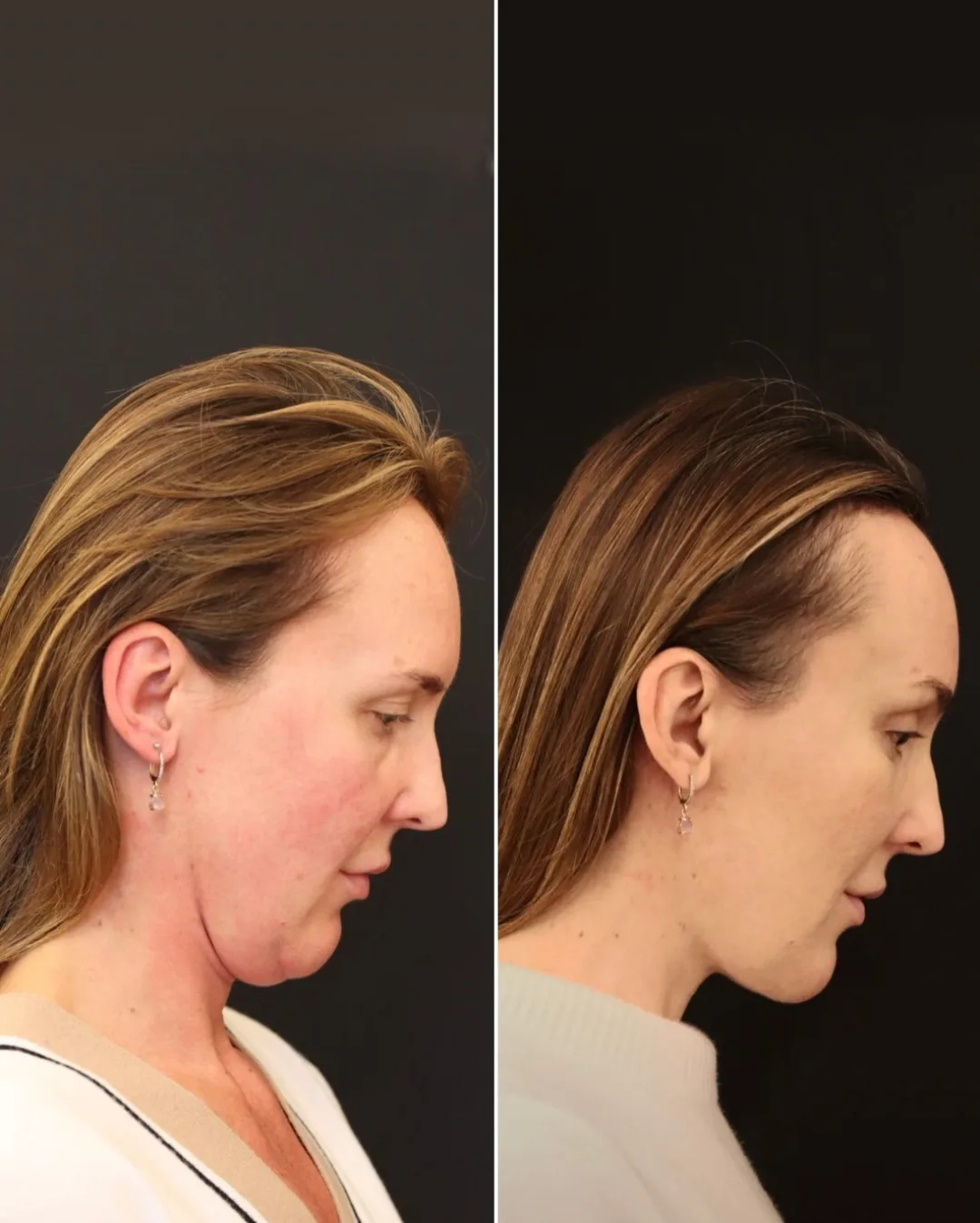 Before and after — Dr. Norman Waterhouse