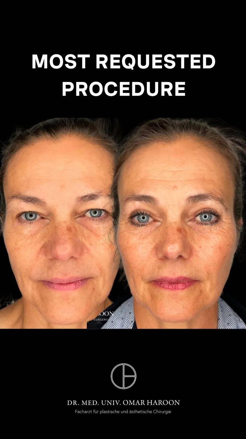 Before and after: Dr. Omar Haroon