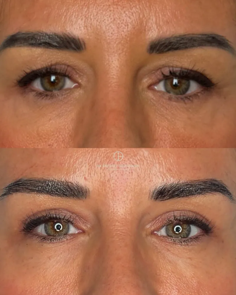 Before and after: Dr. Omar Haroon