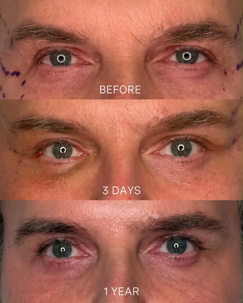 Before and after: Dr. Omar Haroon