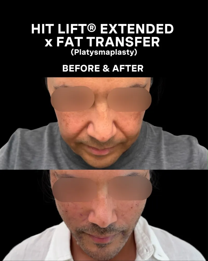 Before and after: Dr. Omar Haroon