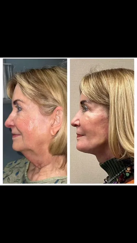 Before and after — Dr. Paige Bundrick