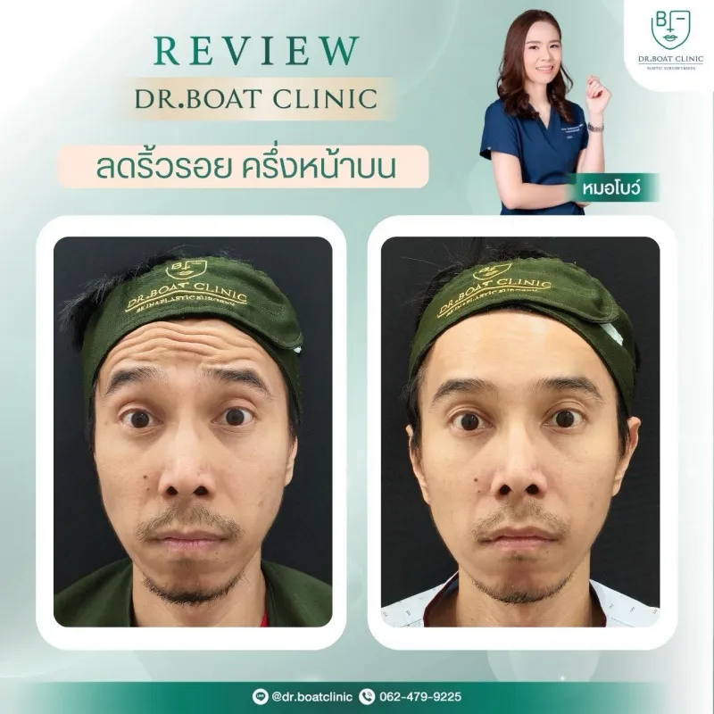 Before and after: Dr. Palapong Chayangsu