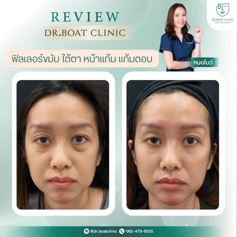 Before and after: Dr. Palapong Chayangsu