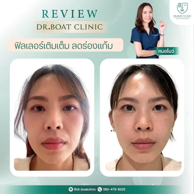 Before and after: Dr. Palapong Chayangsu