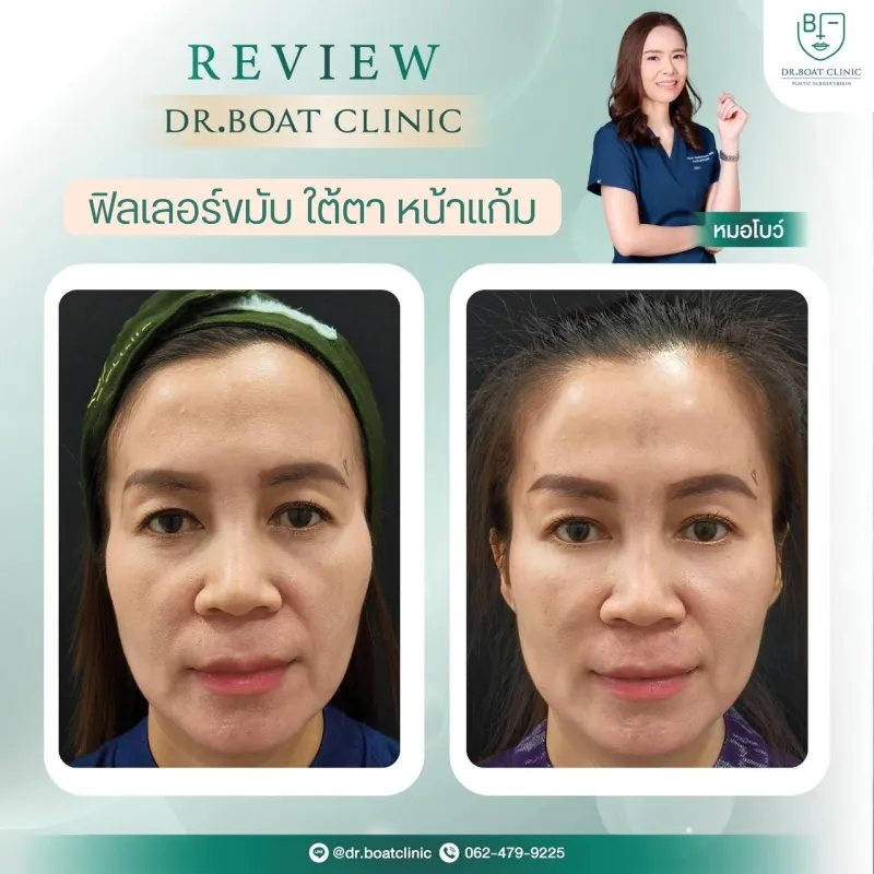 Before and after: Dr. Palapong Chayangsu