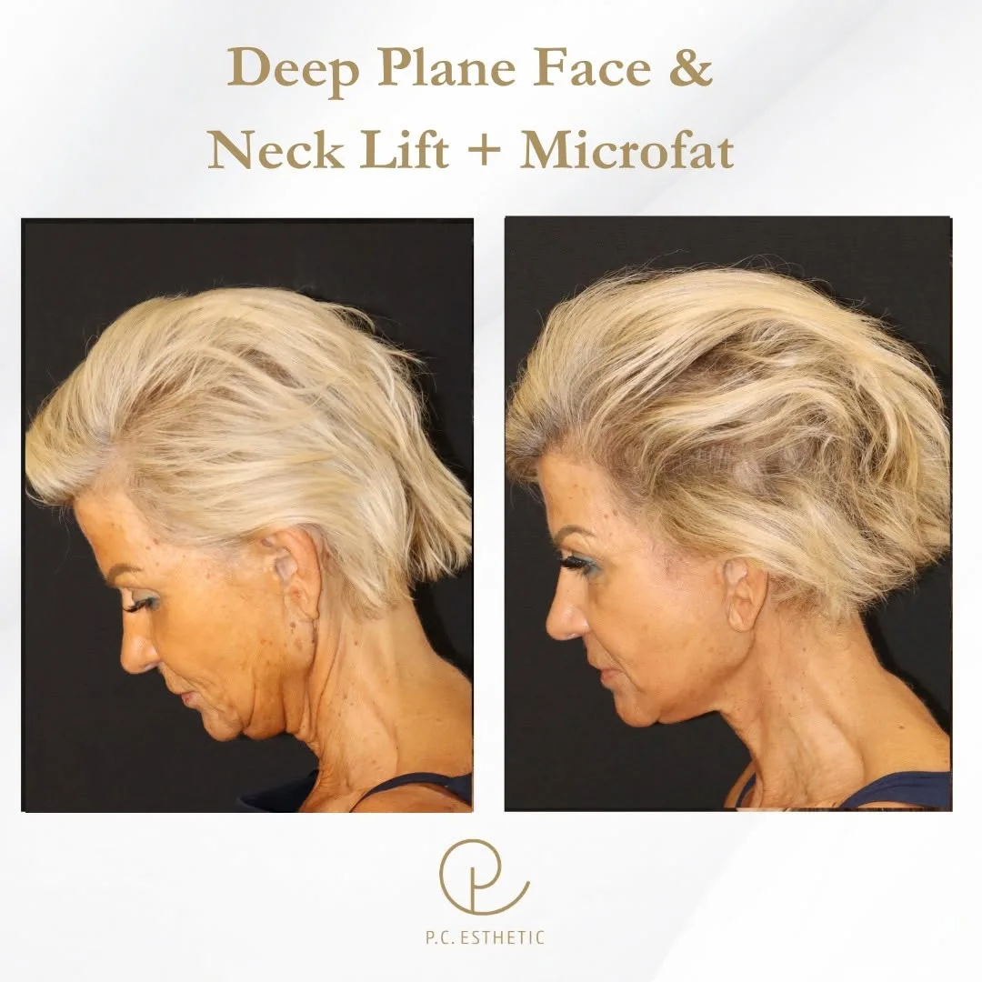 Before and after — Dr. Pascal Castus