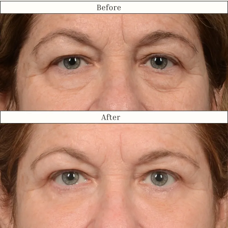 Before and after — Dr. Pasquale Bernardi