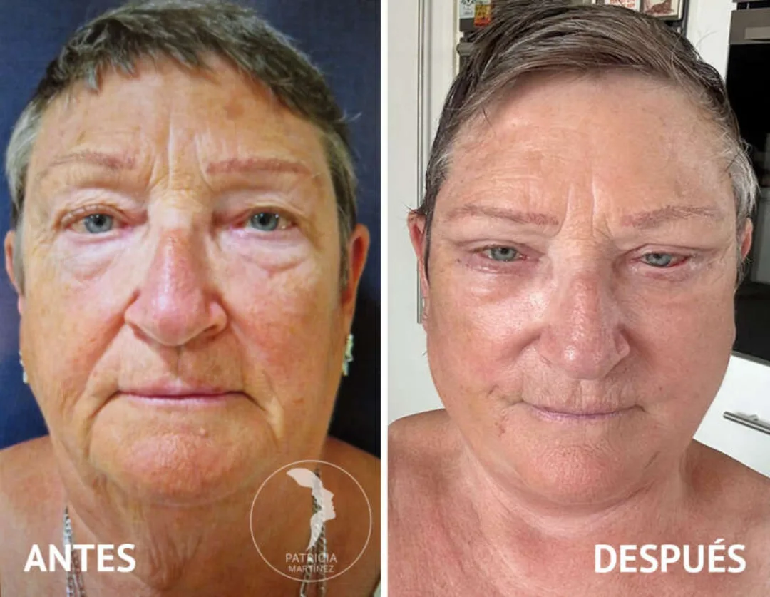 Before and after — Dr. Patricia Martínez