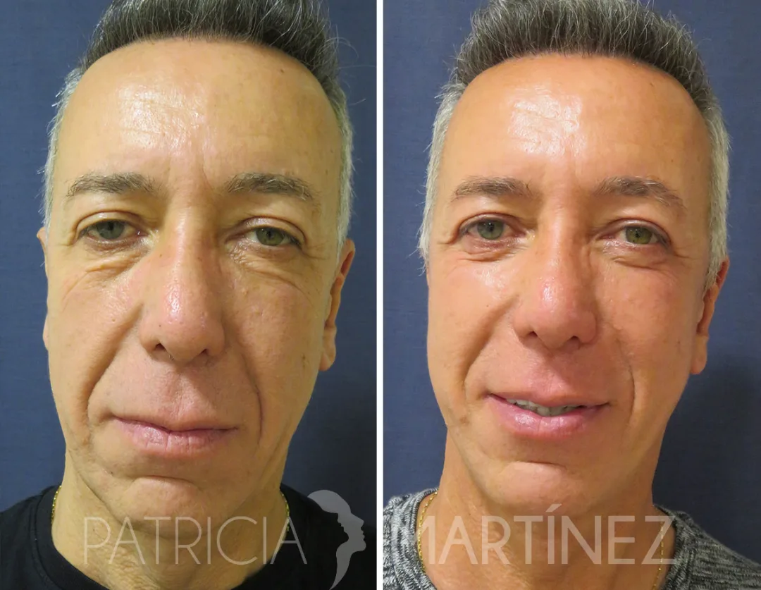 Before and after: Dr. Patricia Martínez