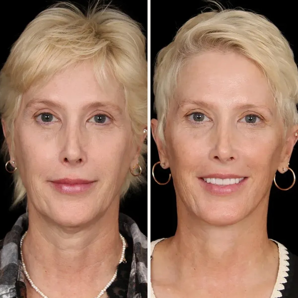 Before and after: Dr. Patrick Davis
