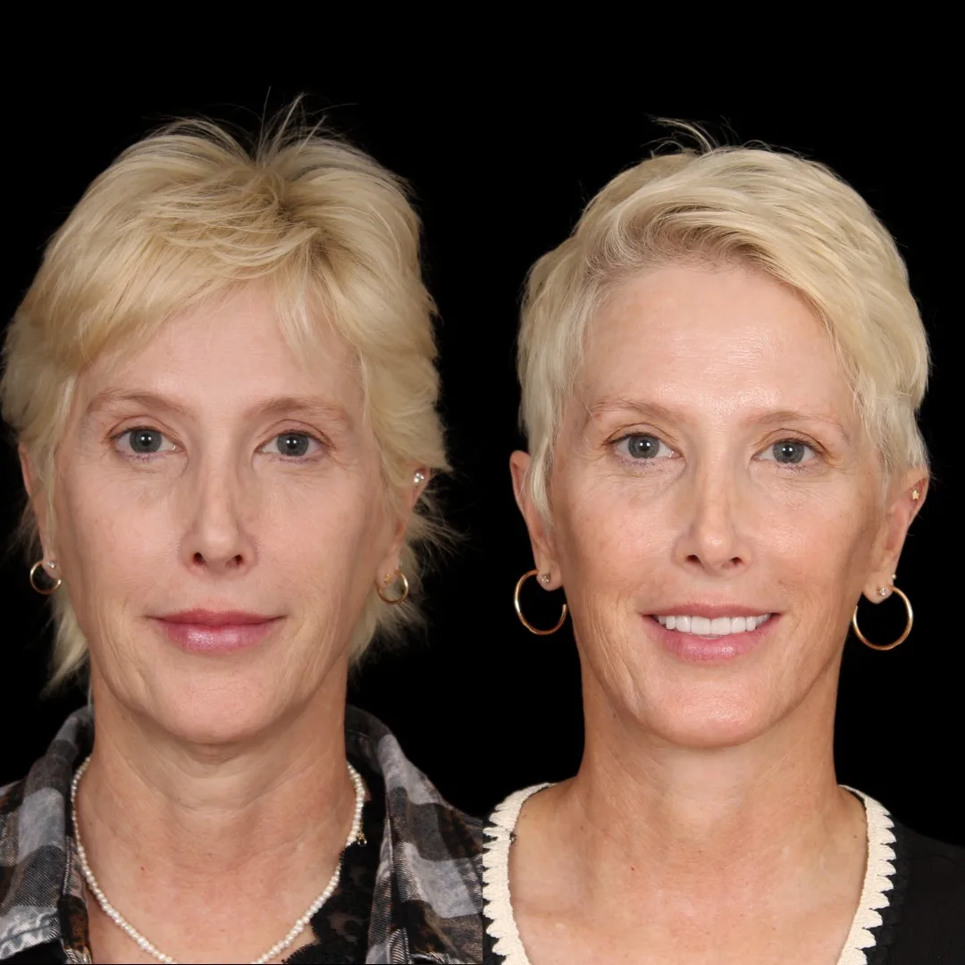 Before and after — Dr. Patrick Davis